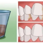 Voici-comment-avoir-des-dents-blanches-naturellement-a-la-maison-1-1200x628